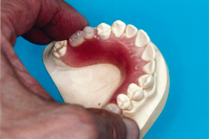 false-teeth-img
